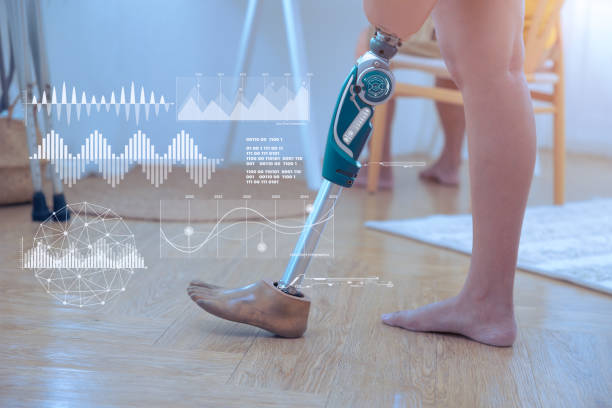 	How long after robotic knee surgery can you walk?