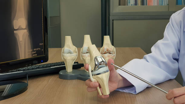 	Advantages of Oxinium Knee Replacement Surgery
