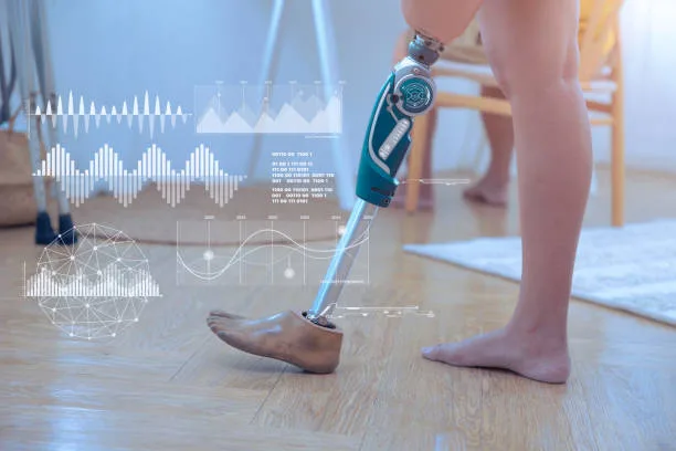 	How long after robotic knee surgery can you walk?