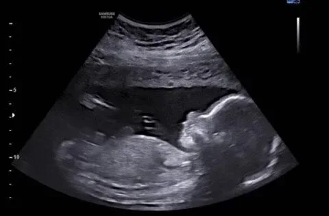 	Beyond Baby Bumps: The Untold Story of Ultrasound in Narellan
